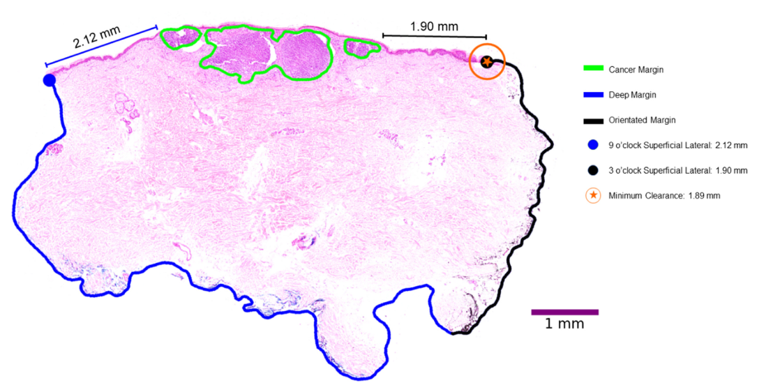 Tissue segmentation